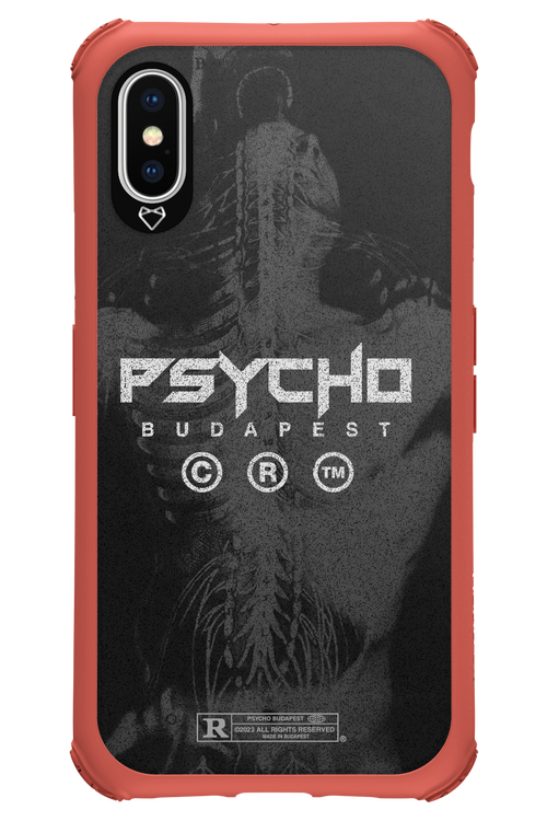 X-Ray - Apple iPhone X