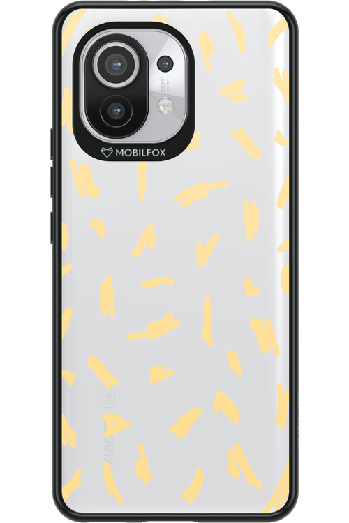 Fries Please - Xiaomi Mi 11 5G